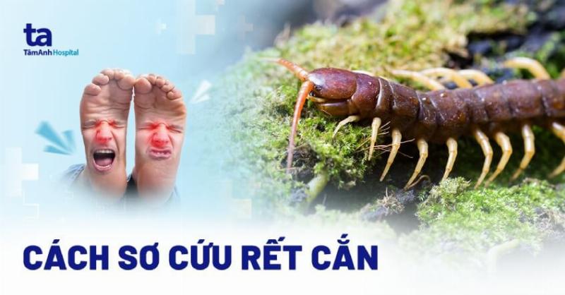 Các dấu hiệu nguy hiểm khi bị rết nhỏ cắn cần đi gặp bác sĩ