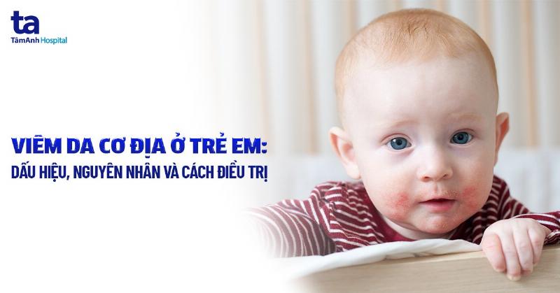 Dấu hiệu cần gặp bác sĩ khi dùng thuốc bôi viêm da cơ địa