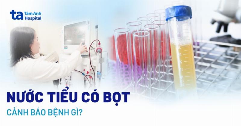 Nước tiểu có bọt do protein niệu