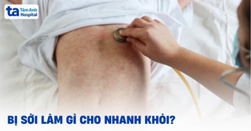 Biện pháp vệ sinh răng miệng hàng ngày giúp phòng ngừa nấm lưỡi ở người lớn tái phát hiệu quả
