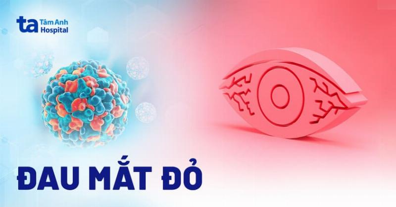 Hình ảnh minh họa các bước vệ sinh mắt bị đau mắt đỏ an toàn và đúng cách