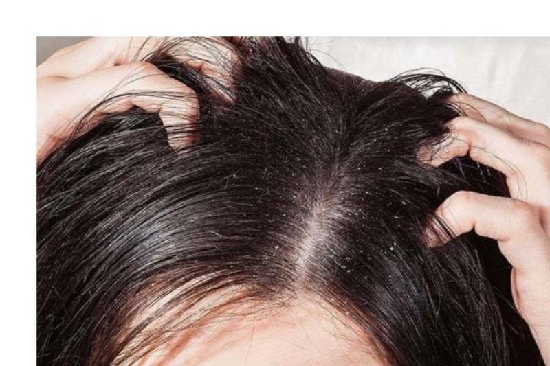 Bo suu tap cac loai thuoc tri nam da dau: dau goi, kem boi va thuoc uong
