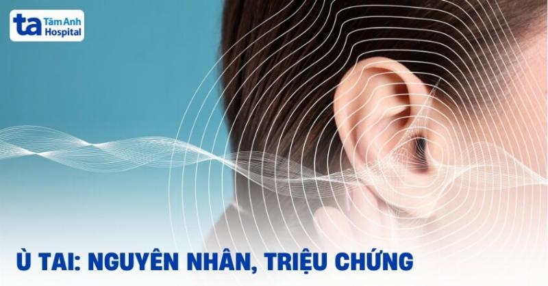 Hình ảnh minh họa các phương pháp quản lý ù tai như máy trợ thính, máy tạo tiếng ồn trắng và hoạt động thư giãn