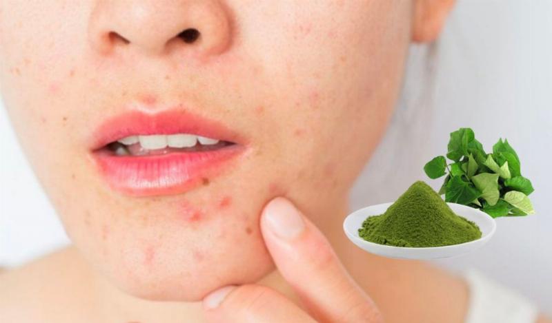 Minh họa cách sử dụng rau diếp cá để làm đẹp da, hỗ trợ trị mụn hiệu quả