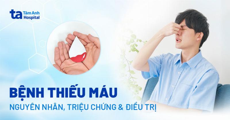 Biểu đồ hoặc hình ảnh minh họa các yếu tố cấu thành sức khỏe mắt toàn diện: dinh dưỡng, vệ sinh, khám định kỳ, lối sống, và việc sử dụng thuốc đúng cách khi cần (minh họa bằng biểu tượng)