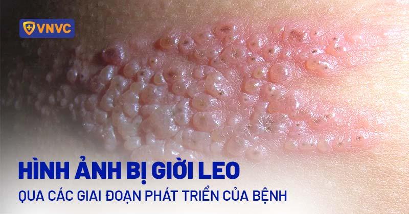 Hinh anh gian cay gac voi nhung trai do mong dang phat trien tren gian leo nhanh