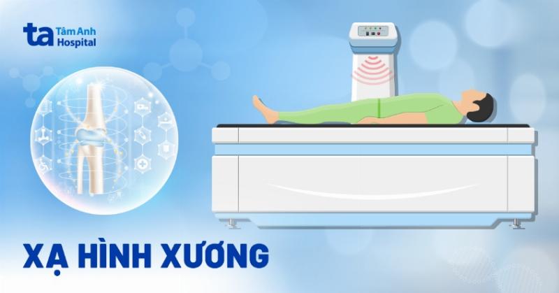 Hình ảnh kết quả chụp xạ hình xương toàn thân cho thấy các điểm nóng tập trung chất đánh dấu