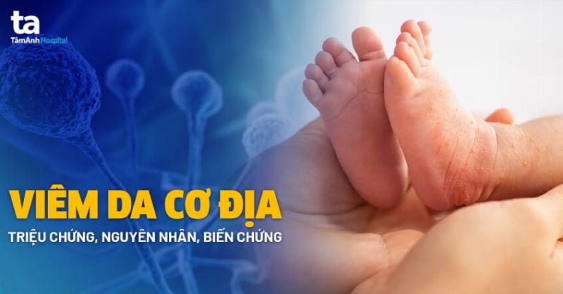 Hình ảnh mô tả môi trường ẩm ướt, tối tăm như góc phòng tắm hoặc phòng thay đồ ẩm thấp, minh họa yếu tố nguy cơ chính dẫn đến nguyên nhân bị hắc lào