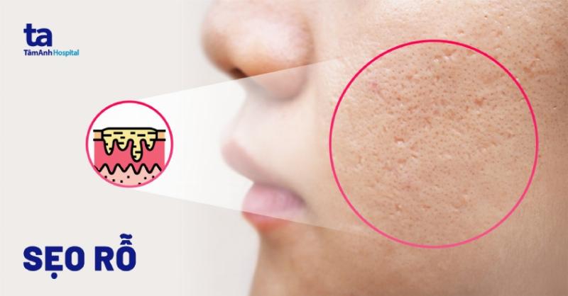 Hình ảnh minh họa quá trình lành sẹo và các loại sẹo phổ biến trên da