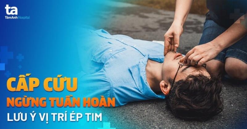 Vai trò quan trọng của người chứng kiến trong cấp cứu ngừng tuần hoàn bộ y tế cộng đồng và sự sống sót của nạn nhân